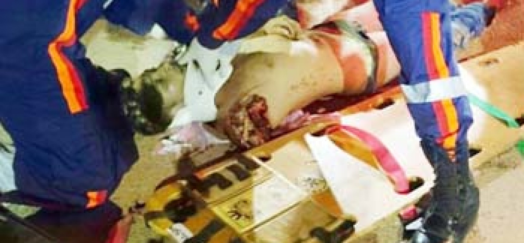Motoqueiro morre em acidente e tem o braço decepado
