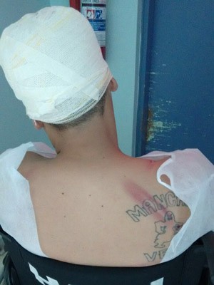 Torcedor ferido em briga em Guarulhos (Foto: Reprodução/Arquivo Pessoal)