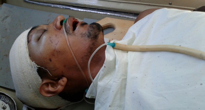 Leandro passou por três cirurgias, o tiro atravessou a cabeça.