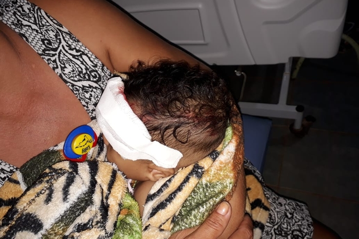 Fazendeiro tenta matar família em Dom Eliseu Criança teve ferimentos na cabeça após choque com a caminhonete (Polícia Civil)