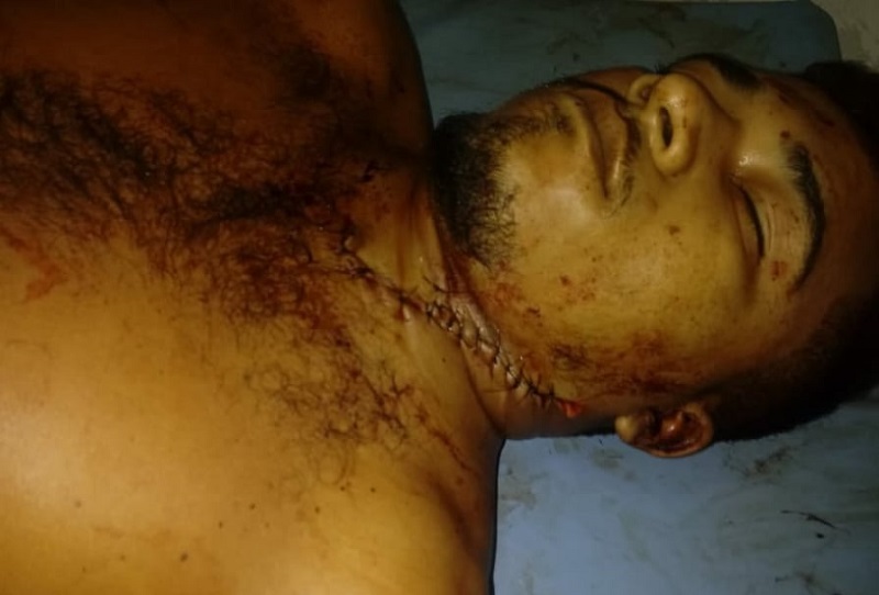 Railson Viana Alves foi morto com uma facada no pescoço. Foi socorrido com vida e morreu no Hospital (Foto:Divulgação)