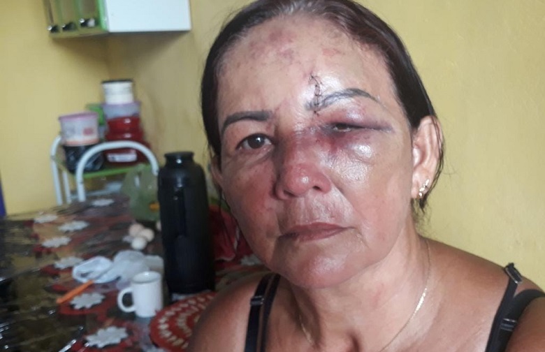 Ela conta que estava em casa quando o ex adentrou na residência. (Foto:Via WhatsApp Jornal Folha do progresso)