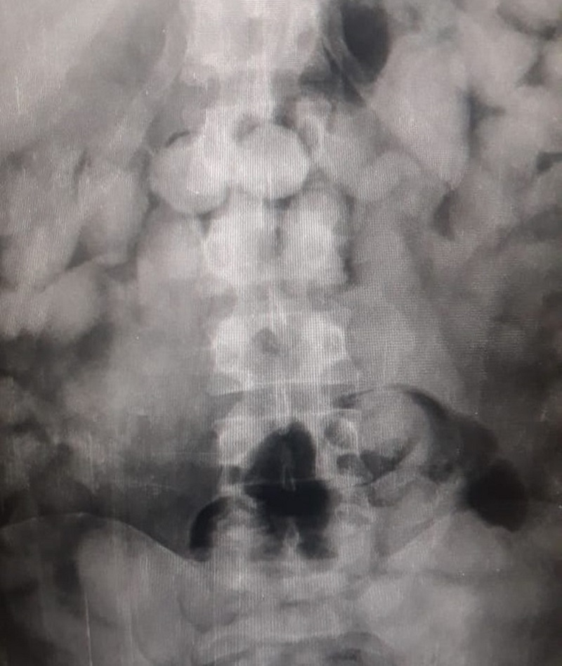 Quarteto tenta transportar cocaína dentro do corpo e é preso no Aeroporto Internacional de Belém — Foto: Reprodução / Assessoria Polícia Federal