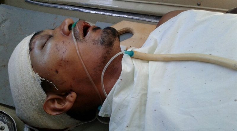 Leandro passou por três cirurgias, o tiro atravessou a cabeça.