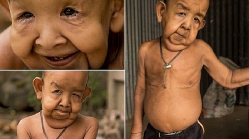 destaque-377026-menino