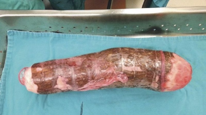 Divulgação internet (Foto)