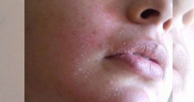 destaque-380229-nara123