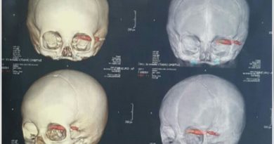 destaque-387955-raio-x