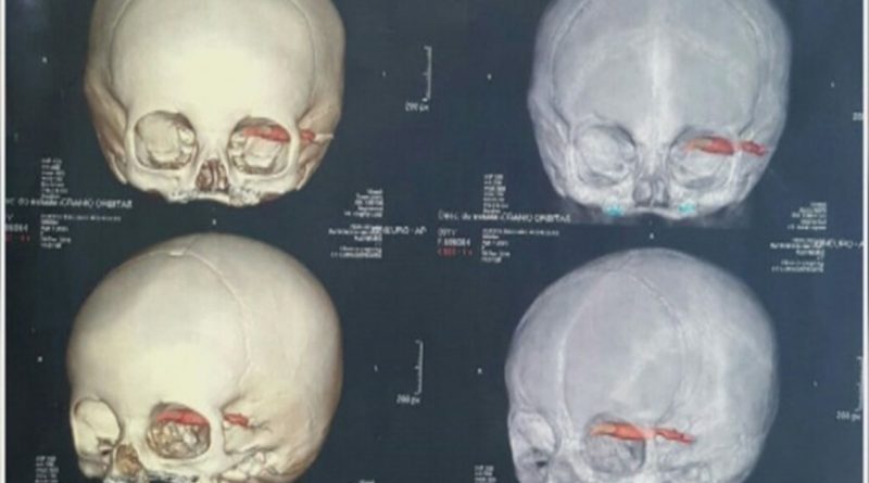 destaque-387955-raio-x