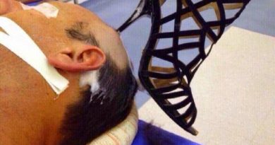 homem-morre-depois-de-ser-agredido-com-tamanco