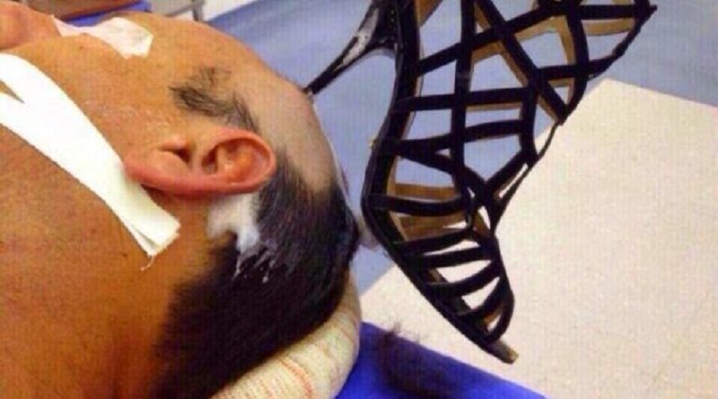 homem-morre-depois-de-ser-agredido-com-tamanco