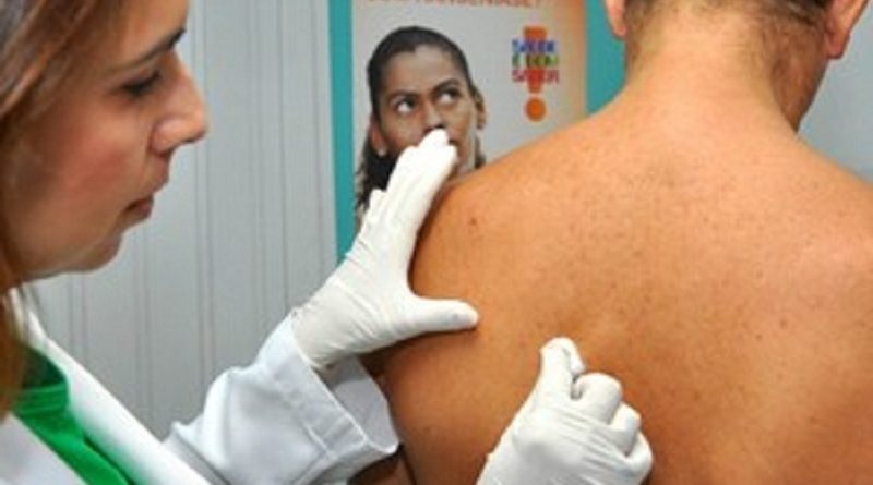 rb_-_exame_de_hanseniase_-_ubsfs