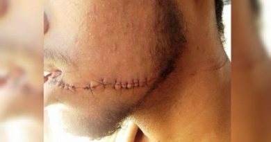 destaque-432125-destaque-432125-jovem