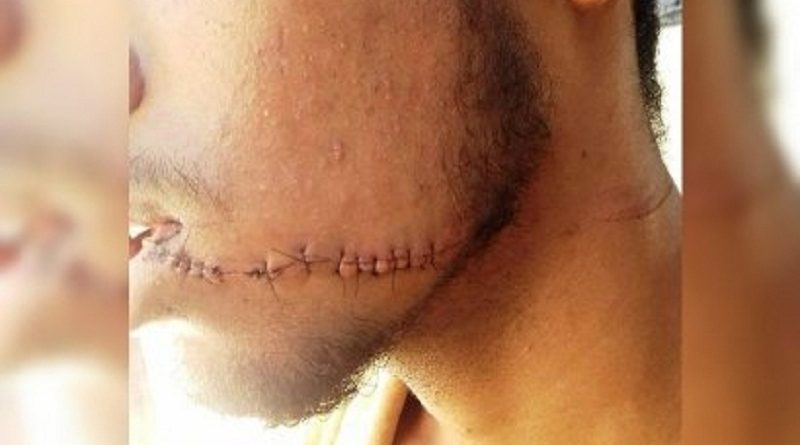 destaque-432125-destaque-432125-jovem