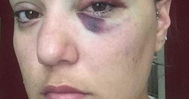 destaque-473129-naom_5a33bd3eda50d