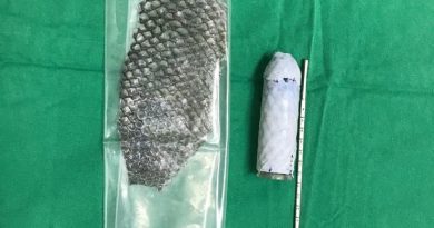 pele-de-tilpia-o-povo