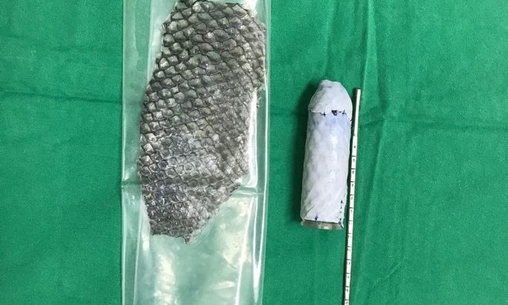 pele-de-tilpia-o-povo