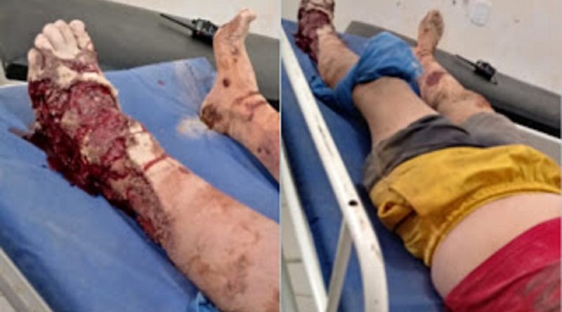 CYMERA_20180906_170025