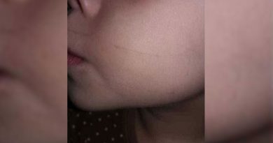 destaque-537448-esparadrapo