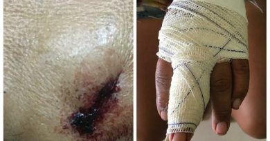 vitimas-de-lesao-corporal-leve