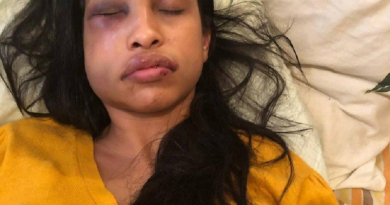 vitima espancada-jogador de futebol