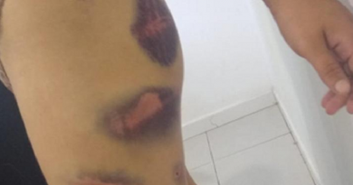 agressoes contra mulher