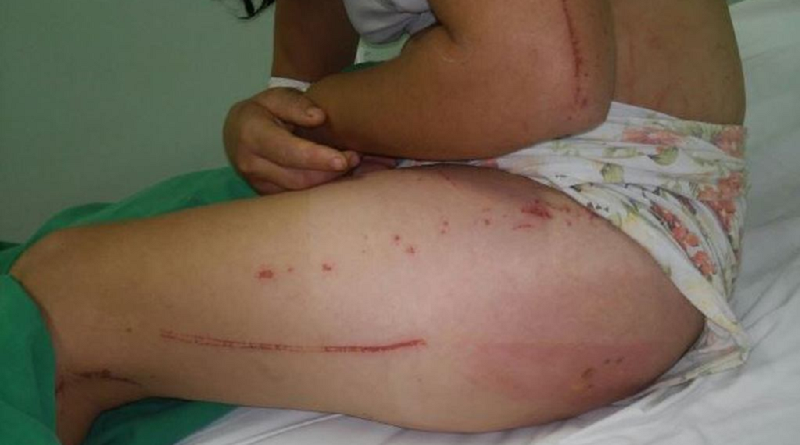 mulher roubada e estrupada