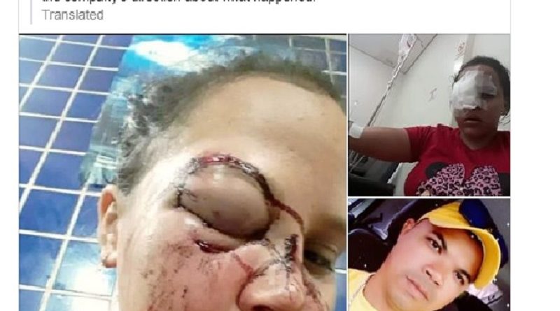 Arlito Ramos atacou ex-namorada e está foragido Imagem: Arquivo Pessoal