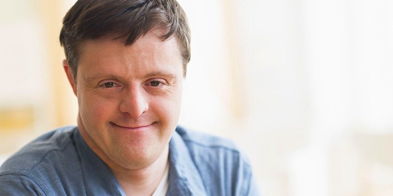 Síndrome-de-Down-Trissomia-21-a