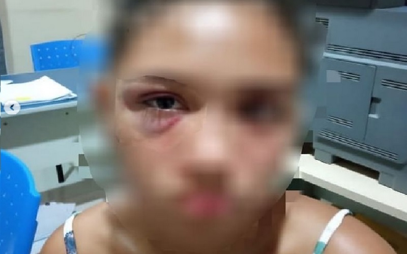  A vítima apresentou hematoma no olho direito (foto:Divulgação PM)