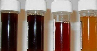 urina preta (Divulgação)