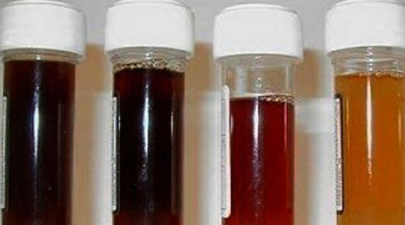 urina preta (Divulgação)