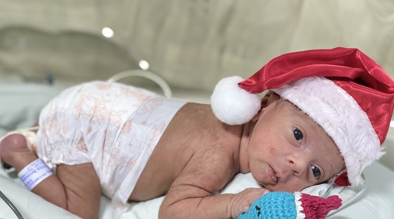 Bebês internados no HRSP participam de ensaio fotográfico de Natal. Fotografia Comunicação Pró-Saúde (2)