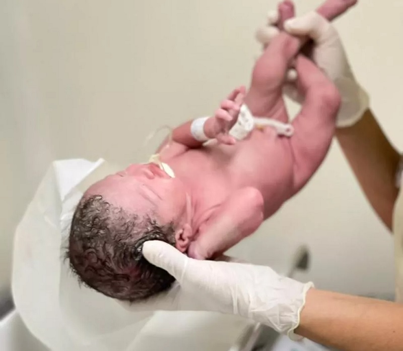  Trigêmeos seguem na UTI Neonatal do hospital. — Foto: Pró-Saúde