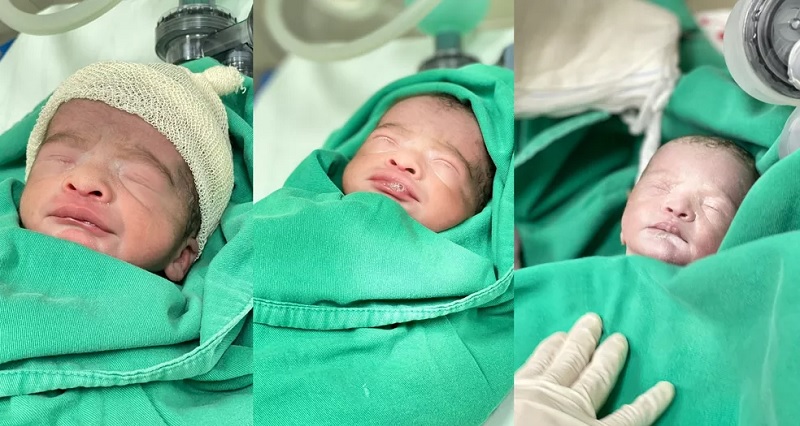  Trigêmeos prematuros nascem no último dia de 2021, em Marabá — Foto: Pró-Saúde
