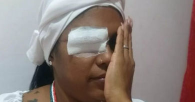 mulher toda facada no olho