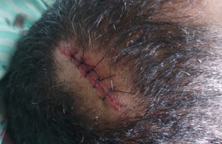 A vítima apresenta diversos ferimentos de arma branca na região da cabeça (Foto:Reprodução/Correio dos Carajás)