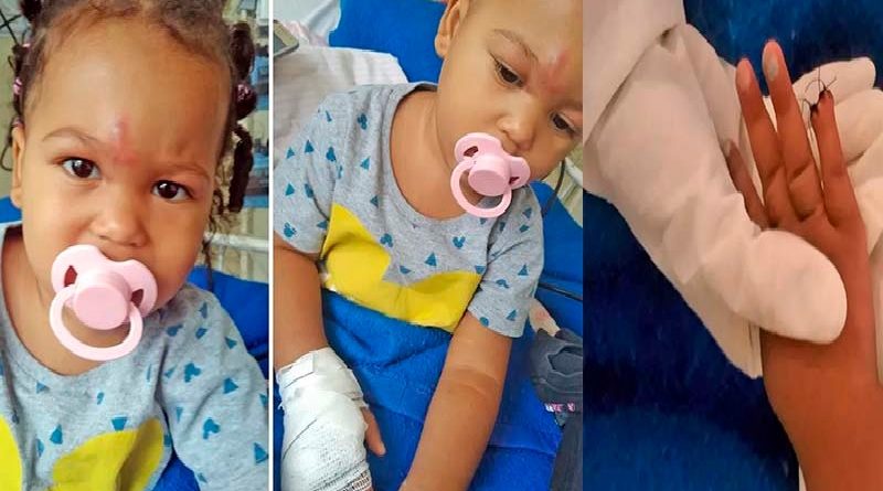 criança dedo cortado