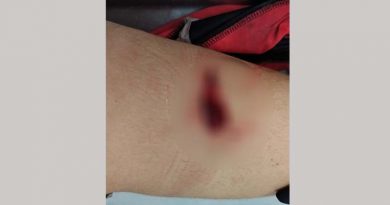 adolescente-esfaqueado