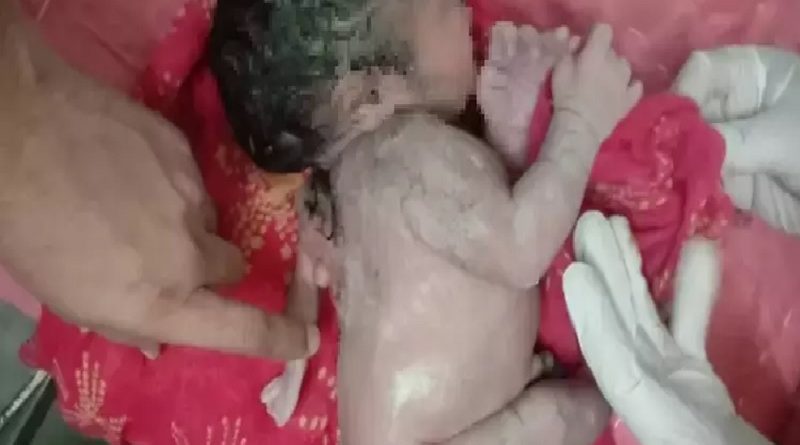 criança tres braço