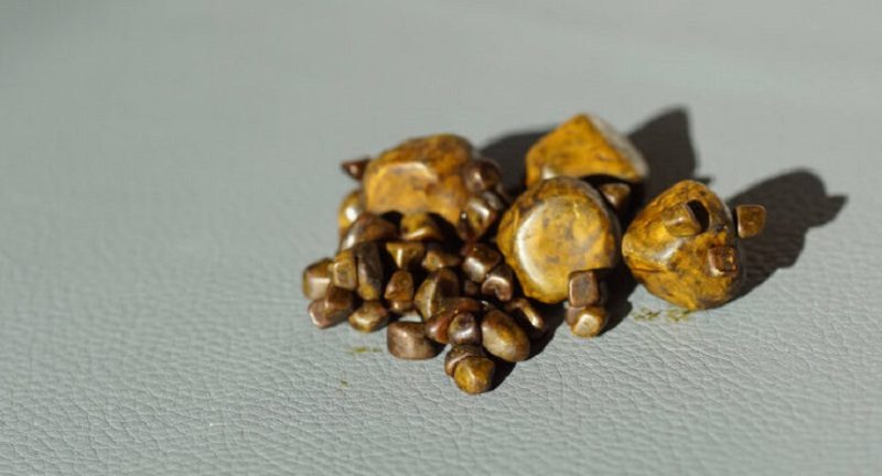 pedra-de-fel-do-boi-740x400