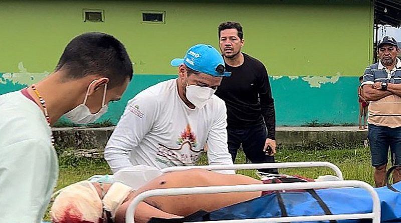 Atentado a Yanomamis - Na tarde deste sábado (29/04) garimpeiros armados alvejaram três (03) jovens Yanomami, sendo um (01) deles, agente indígena de saúde da Comunidade Uxiú. Foto: Hekurari/INSTAGRAM