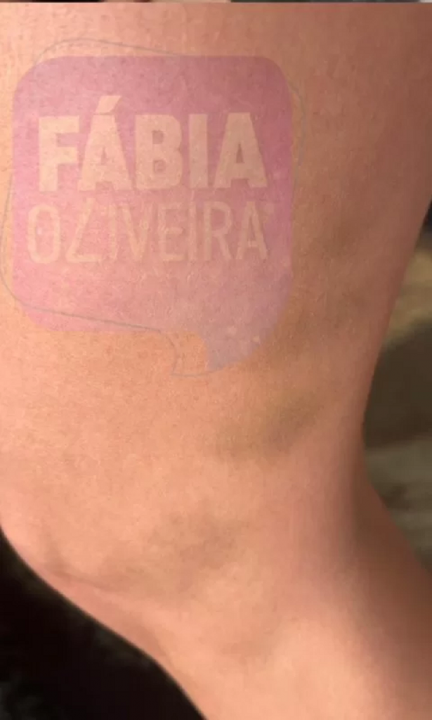 Cortes e hematomas: veja fotos de Maria Melilo após agressões do ex    Cortes e hematomas: veja fotos de Maria Melilo após agressões do ex    Cortes e hematomas: veja fotos de Maria Melilo após agressões do ex