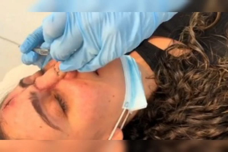 Tratamento exigiu força física e mental da jovem | Foto: Redes sociais