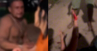 fhgd