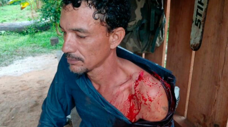 O posseiro Nacione Sampaio foi torturado e gravemente ferido com um golpe de facão na clavícula- (Foto: Reprodução)