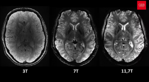 Visão axial do cérebro, sob o mesmo tempo de aquisição, mas com diferentes intensidades de campo magnético. — Foto: Reprodução/Comissão de Energia Atômica da França (CEA)