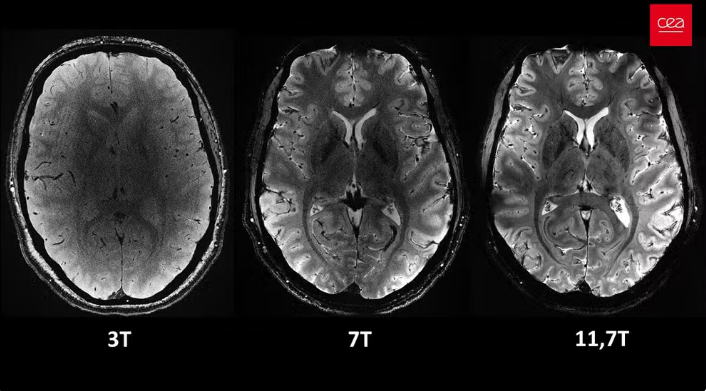 Visão axial do cérebro, sob o mesmo tempo de aquisição, mas com diferentes intensidades de campo magnético. — Foto: Reprodução/Comissão de Energia Atômica da França (CEA)