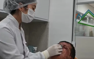 Ronaldo, portador de xeroderma pigmentoso, já passou por 230 cirurgias. Conheça sua história e a luta por qualidade de vida. | (Instituto Mais Identidade/Divulgação)