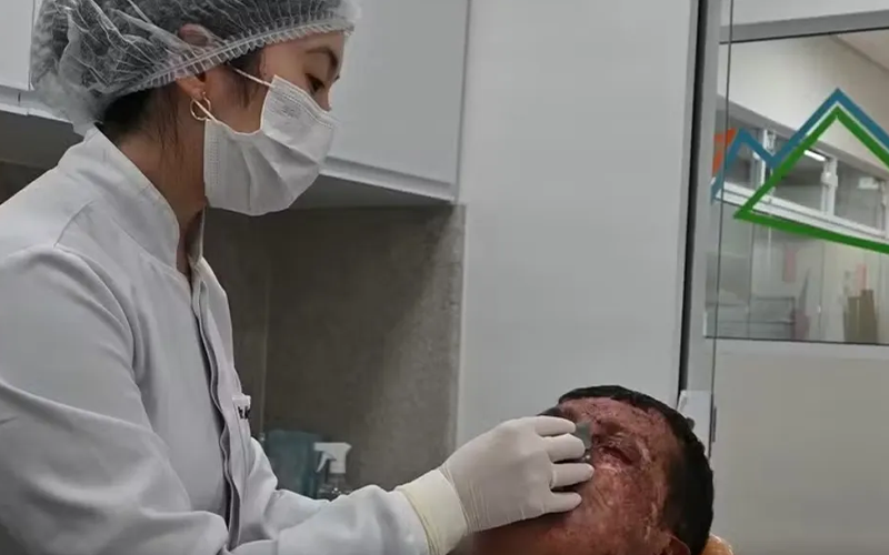 Ronaldo, portador de xeroderma pigmentoso, já passou por 230 cirurgias. Conheça sua história e a luta por qualidade de vida. | (Instituto Mais Identidade/Divulgação)